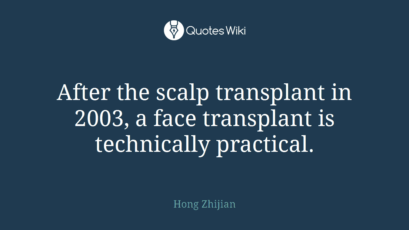 After the scalp transplant in 2003, a face transplant is technically practical.