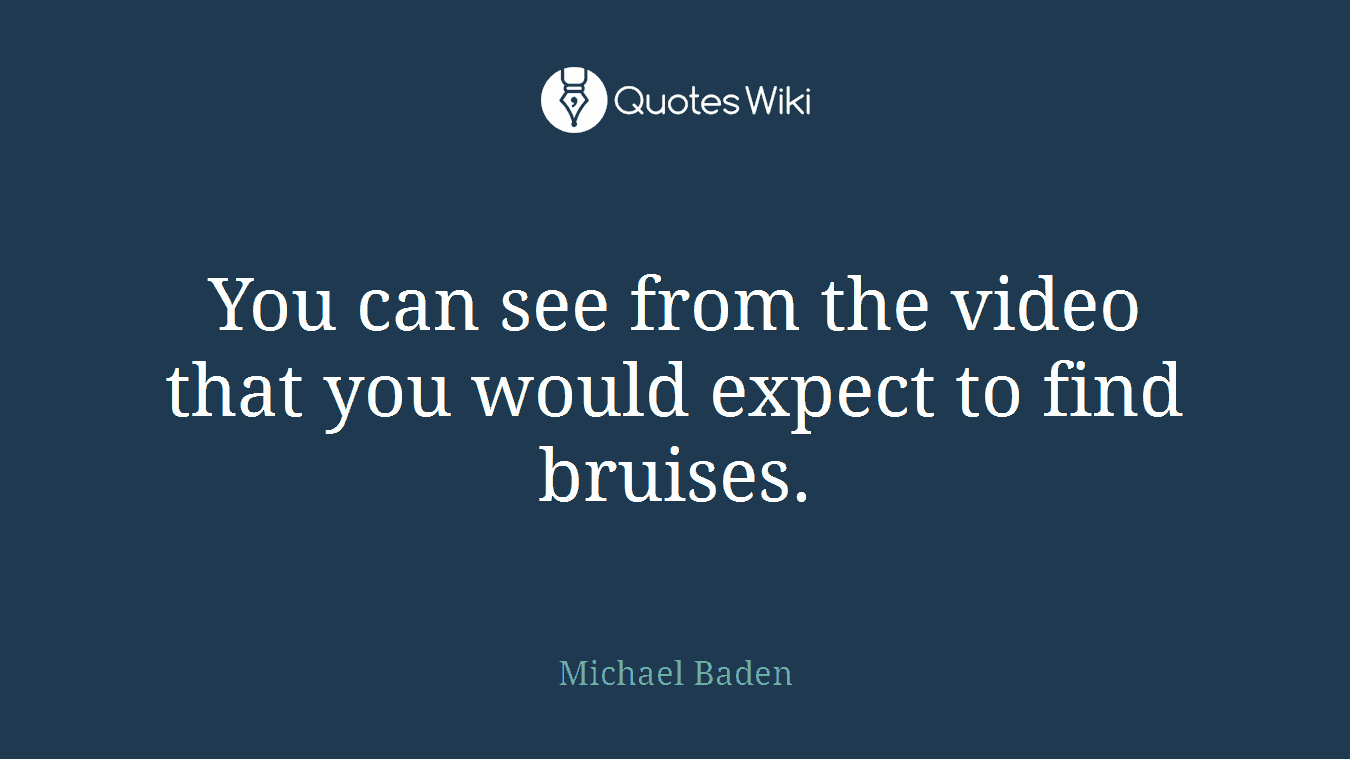 You can see from the video that you would expect to find bruises.